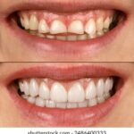 2018欧冠决赛直播平台及电视频道全解析 berycjq