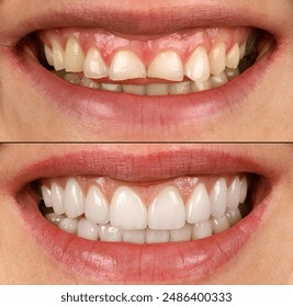 2018欧冠决赛直播平台及电视频道全解析